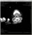 My Gallery: Image