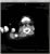 My Gallery: Image