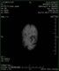 My Gallery: Image