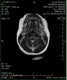 My Gallery: Image